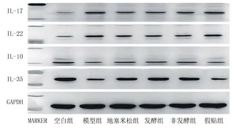 空白組和支氣管哮喘各組大鼠肺組織中IL－17、IL－22、IL－10、IL－35蛋白表達(dá)電泳圖